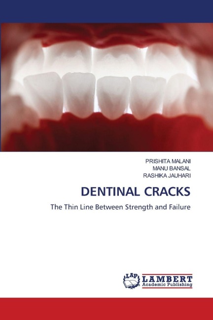 DENTINAL CRACKS: The Thin Line Between Strength and Failure