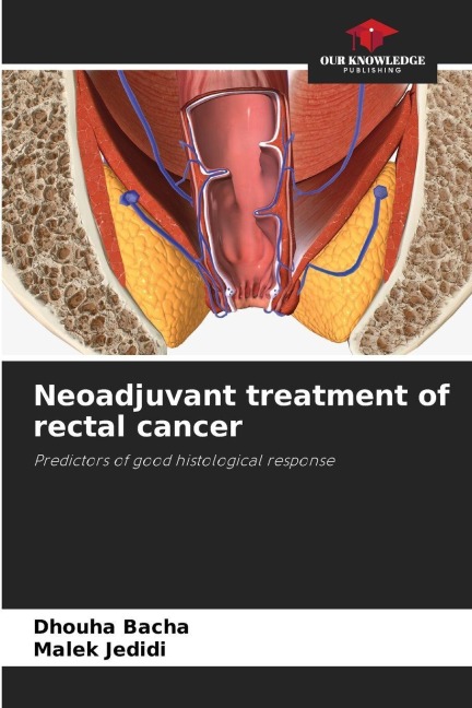 Neoadjuvant treatment of rectal cancer: Predictors of good histological response