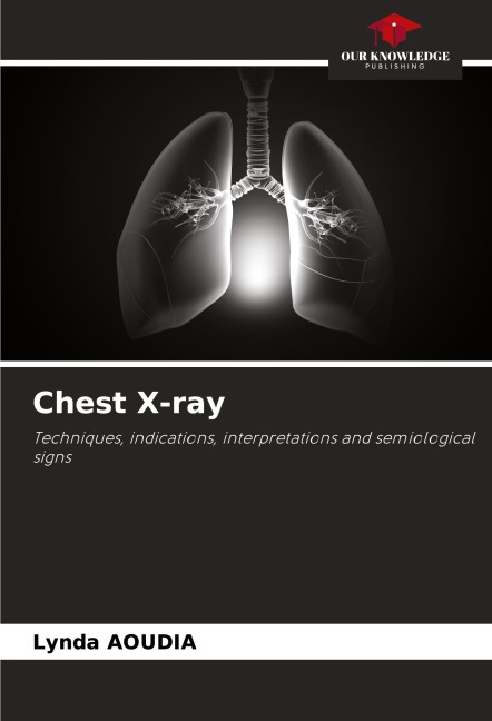 Chest X-ray: Techniques, indications, interpretations and semiological signs