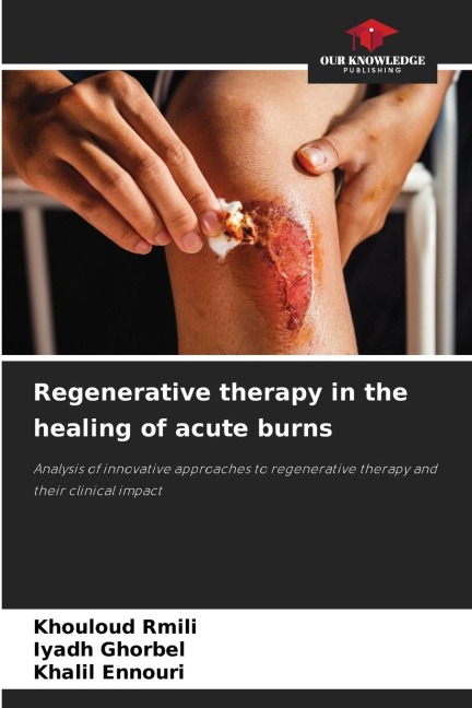 Regenerative therapy in the healing of acute burns: Analysis of innovative approaches to regenerative therapy and their clinical impact