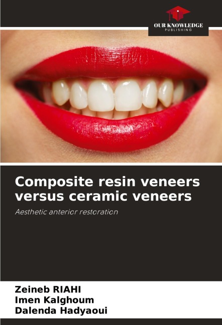 Composite resin veneers versus ceramic veneers: Aesthetic anterior restoration