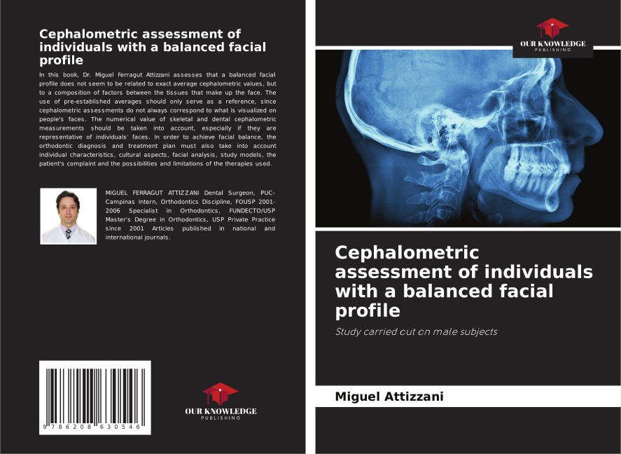 Cephalometric assessment of individuals with a balanced facial profile: Study carried out on male subjects
