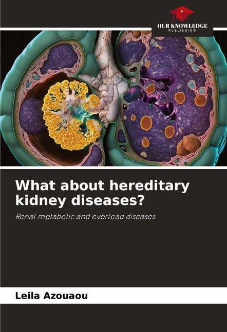 What about hereditary kidney diseases?: Renal metabolic and overload diseases