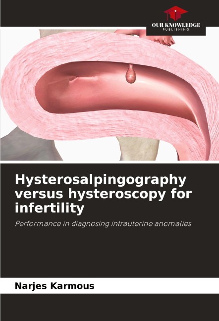 Hysterosalpingography versus hysteroscopy for infertility: Performance in diagnosing intrauterine anomalies