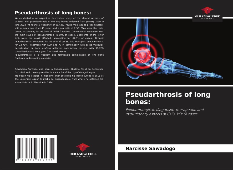 Pseudarthrosis of long bones:: Epidemiological, diagnostic, therapeutic and evolutionary aspects at CHU-YO: 61 cases