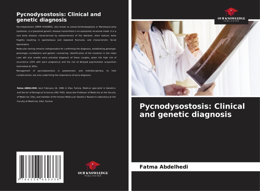 Pycnodysostosis: Clinical and genetic diagnosis