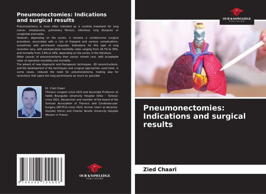 Pneumonectomies: Indications and surgical results