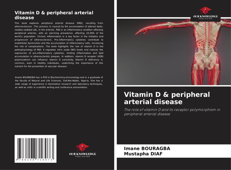 Vitamin D & peripheral arterial disease: The role of vitamin D and its receptor polymorphism in peripheral arterial disease
