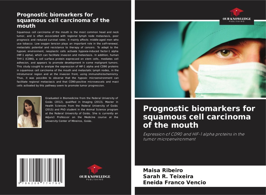 Prognostic biomarkers for squamous cell carcinoma of the mouth: Expression of CD90 and HIF-1 alpha proteins in the tumor microenvironment