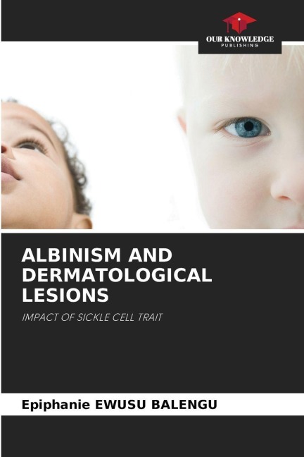 ALBINISM AND DERMATOLOGICAL LESIONS: IMPACT OF SICKLE CELL TRAIT