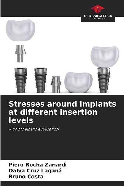 Stresses around implants at different insertion levels: A photoelastic evaluation