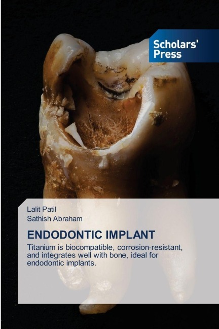 ENDODONTIC IMPLANT: Titanium is biocompatible, corrosion-resistant, and integrates well with bone, ideal for endodontic implants.