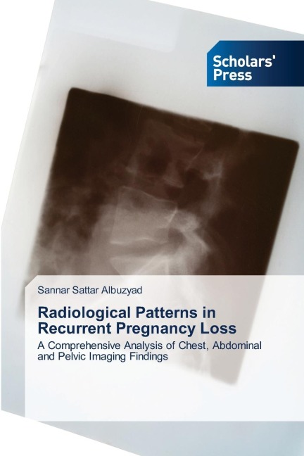 Radiological Patterns in Recurrent Pregnancy Loss: A Comprehensive Analysis of Chest, Abdominal and Pelvic Imaging Findings