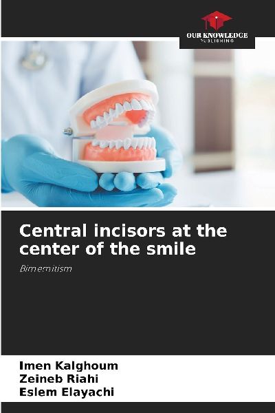Central incisors at the center of the smile: Bimemitism