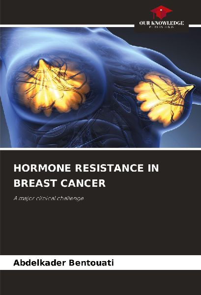 HORMONE RESISTANCE IN BREAST CANCER: A major clinical challenge