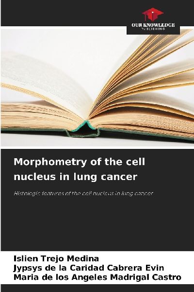 Morphometry of the cell nucleus in lung cancer: Histologic features of the cell nucleus in lung cancer