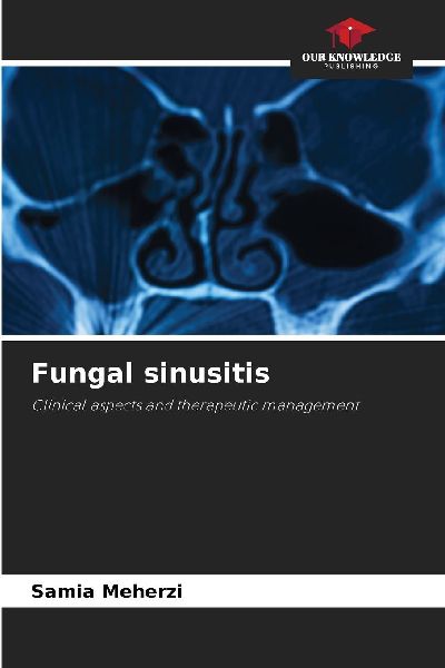 Fungal sinusitis: Clinical aspects and therapeutic management