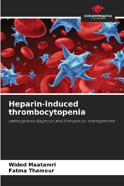 Heparin-induced thrombocytopenia: pathogenesis diagnosis and therapeutic management