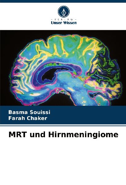 MRT und Hirnmeningiome