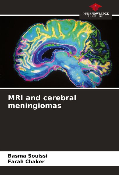 MRI and cerebral meningiomas