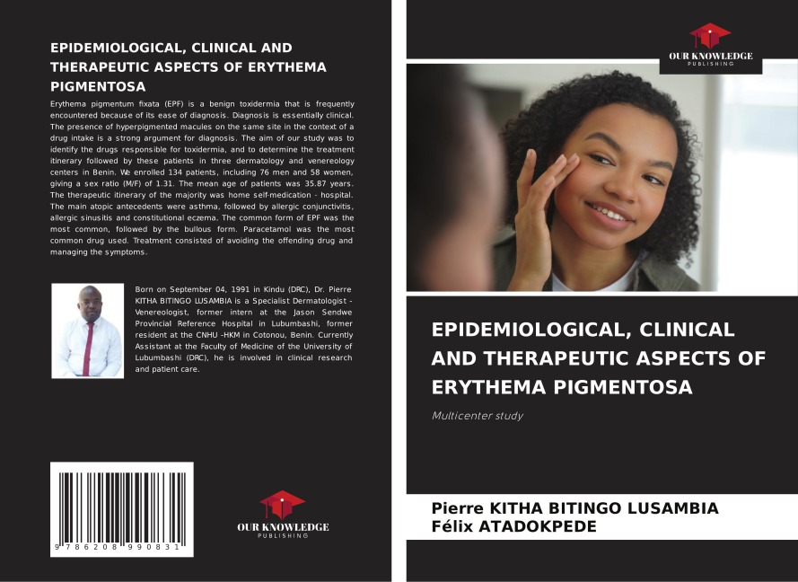 Epidemiological, Clinical and Therapeutic Aspects of Erythema Pigmentosa