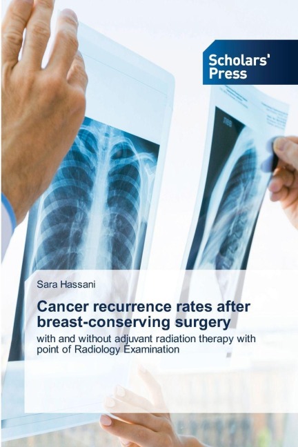 Cancer recurrence rates after breast-conserving surgery: with and without adjuvant radiation therapy with point of Radiology Examination
