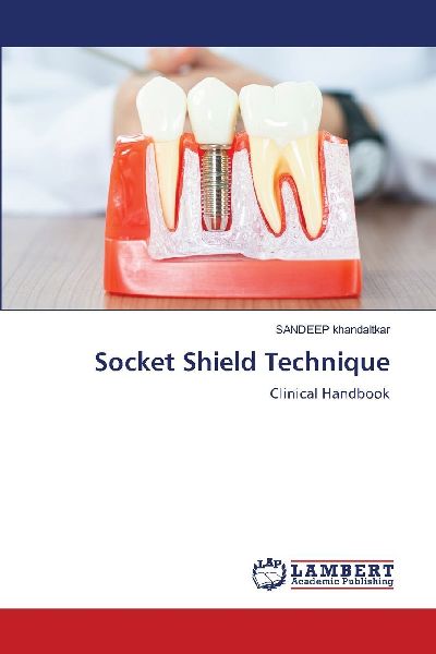 Socket Shield Technique: Clinical Handbook