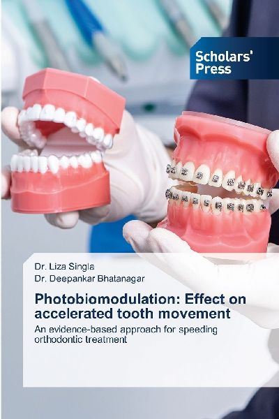 Photobiomodulation: Effect on accelerated tooth movement: An evidence-based approach for speeding orthodontic treatment