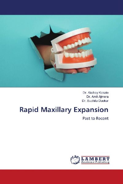 Rapid Maxillary Expansion: Past to Recent