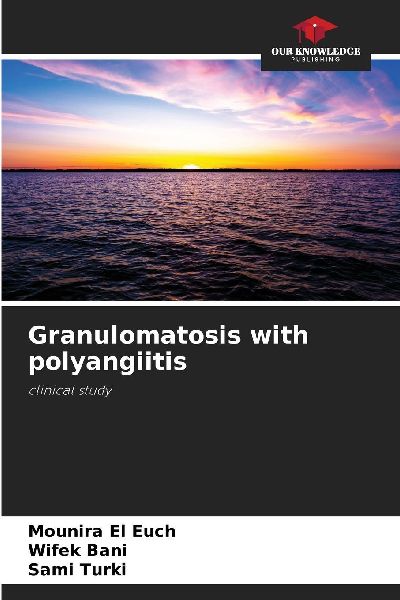 Granulomatosis with polyangiitis: clinical study