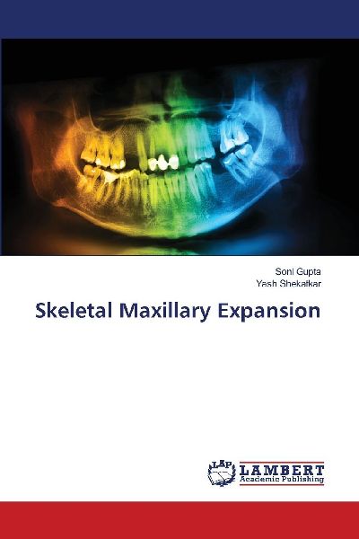 Skeletal Maxillary Expansion