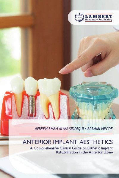 ANTERIOR IMPLANT AESTHETICS: A Comprehensive Clinical Guide to Esthetic Implant Rehabilitation in the Anterior Zone