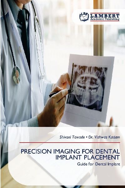PRECISION IMAGING FOR DENTAL IMPLANT PLACEMENT: Guide for Dental Implant