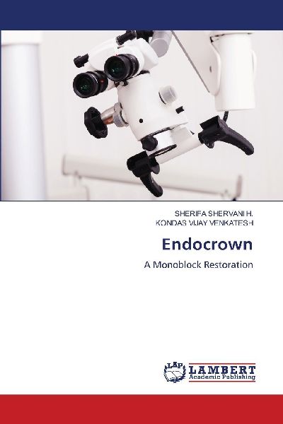 Endocrown: A Monoblock Restoration