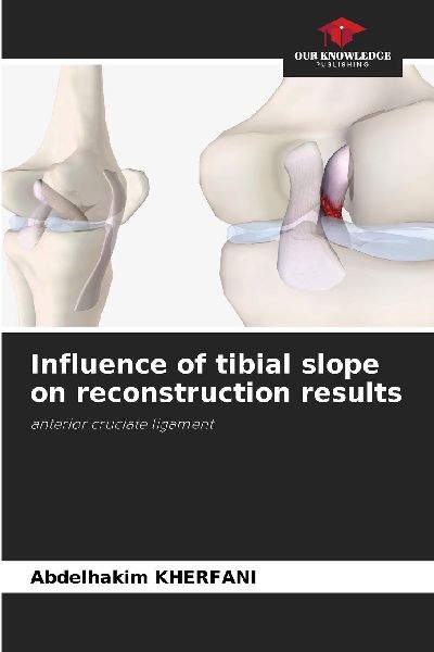 Influence of tibial slope on reconstruction results: anterior cruciate ligament