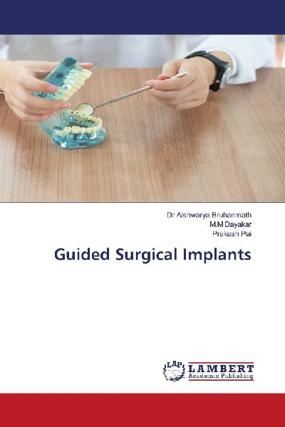 Guided Surgical Implants