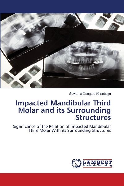 Impacted Mandibular Third Molar and its Surrounding Structures: Significance of the Relation of Impacted Mandibular Third Molar With its Surrounding Structures