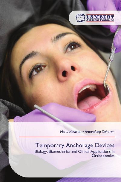 Temporary Anchorage Devices: Biology, Biomechanics and Clinical Applications in Orthodontics