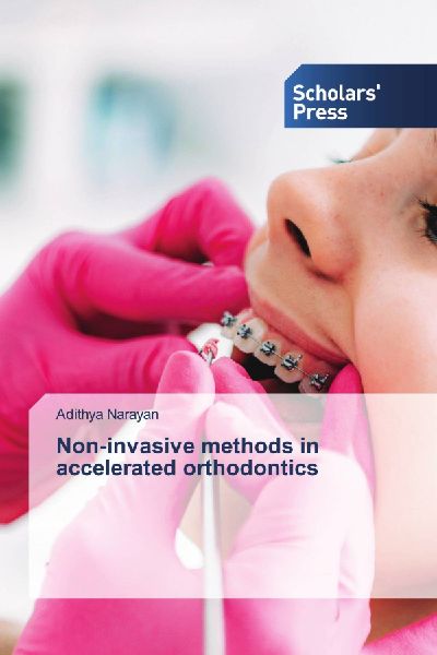 Non-invasive methods in accelerated orthodontics