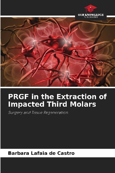 PRGF in the Extraction of Impacted Third Molars: Surgery and Tissue Regeneration