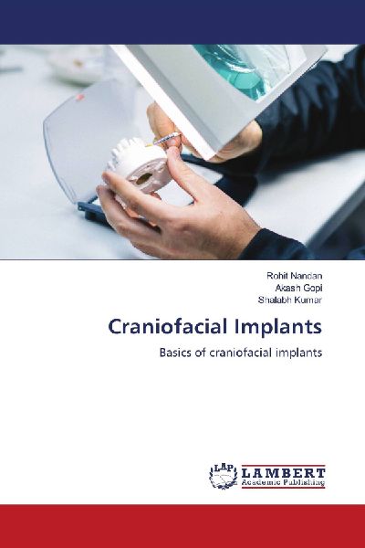Craniofacial Implants: Basics of craniofacial implants