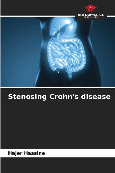 Stenosing Crohns disease
