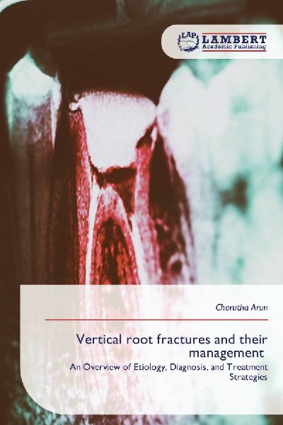 Vertical root fractures and their management: An Overview of Etiology, Diagnosis, and Treatment Strategies