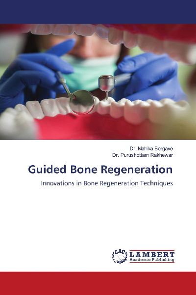 Guided Bone Regeneration: Innovations in Bone Regeneration Techniques