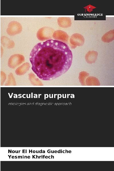 Vascular purpura: etiologies and diagnostic approach