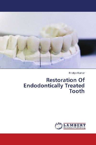 Restoration Of Endodontically Treated Tooth