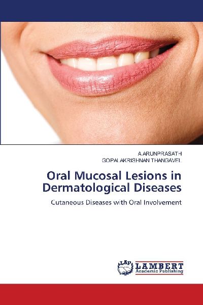 Oral Mucosal Lesions in Dermatological Diseases