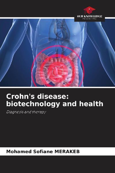Crohns disease: biotechnology and health: Diagnosis and therapy