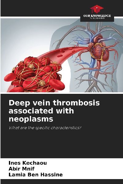 Deep vein thrombosis associated with neoplasms: What are the specific characteristics?
