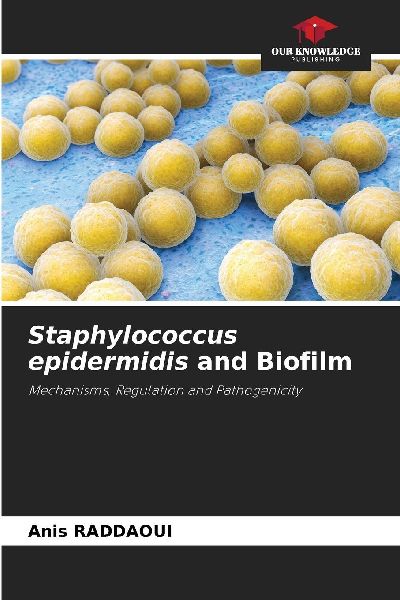 Staphylococcus epidermidis and Biofilm: Mechanisms, Regulation and Pathogenicity
